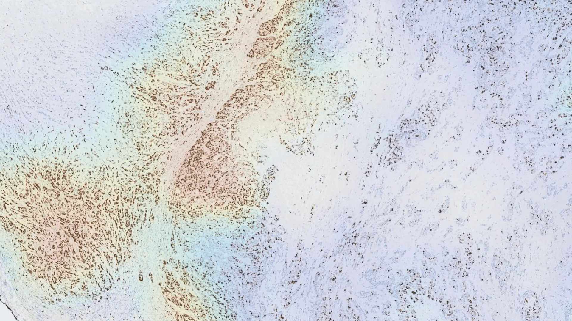 /images/qanti-IHC/Hotspot Visualization.webp